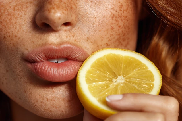 Freckled Skin and Lemon Slice Citrus Theme Healthy Skin