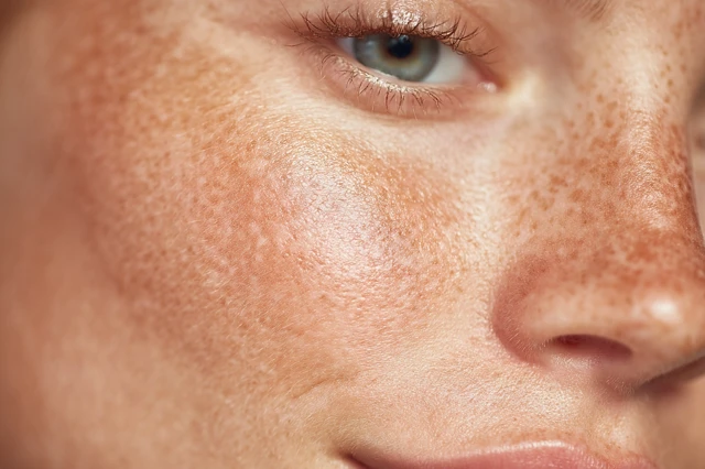 Macro Female Skin Freckles and Natural Beauty