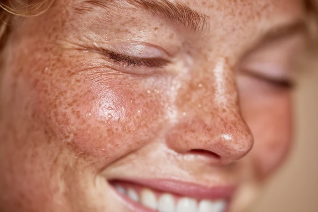 Macro Female Skin Freckles and Natural Beauty